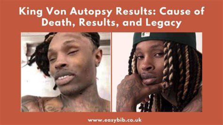 King Von Autopsy: The Untold Story Behind the Tragic Loss