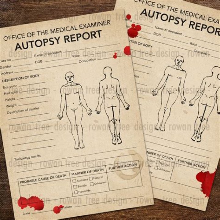 Paul Walker Autopsy Report: A Detailed Analysis